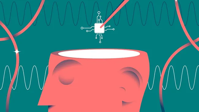 Neuralink İlk Kullanıcısı